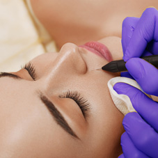 Thermal cautery​ icon